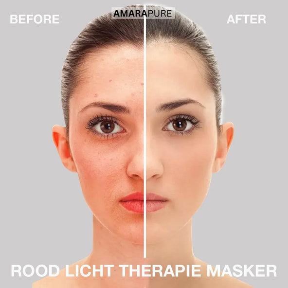 Rotlichttherapie: der bewährte Boost für Haut, Energie und Regeneration